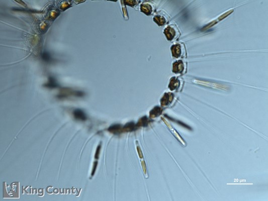 Photo of Pseudo-nitzschia americana